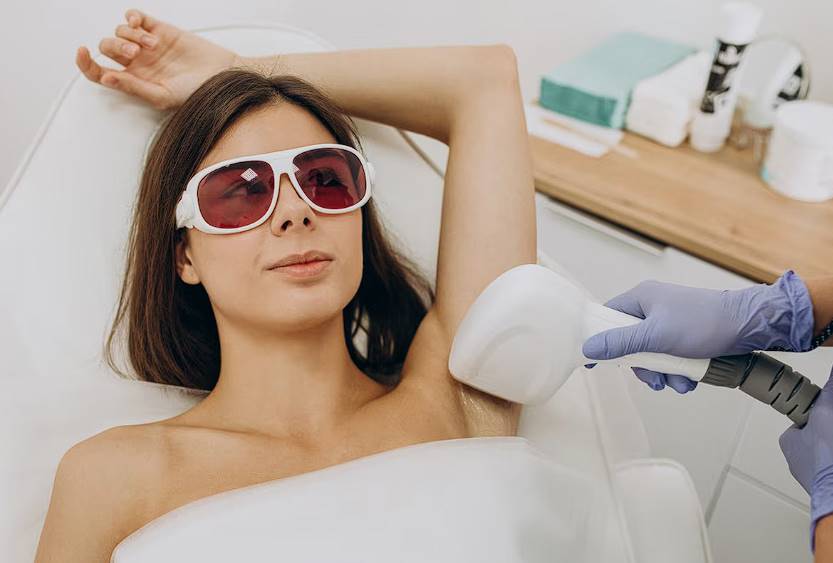 a comprehensive guide to laser hair removal