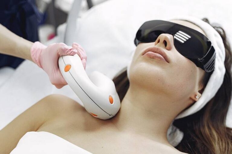 are-laser-skin-treatments-effective-for-birthmark-removal