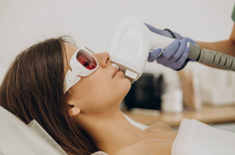 can laser hair removal help manage excessive sweating