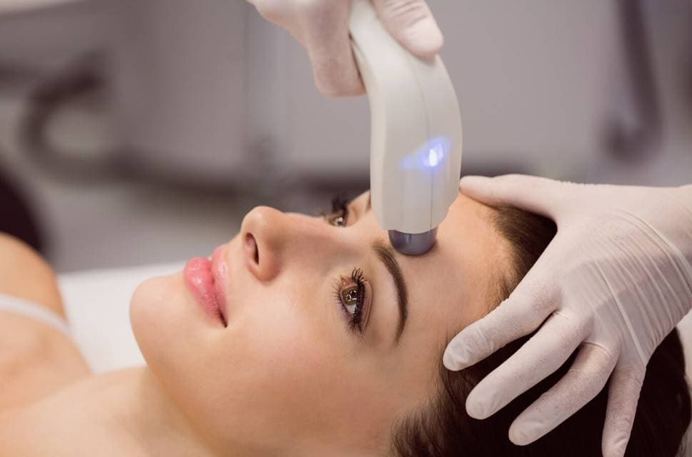 chemical peels or laser treatments
