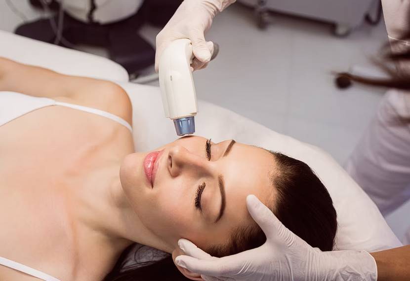 how effective are laser skin treatments for acne scars 1