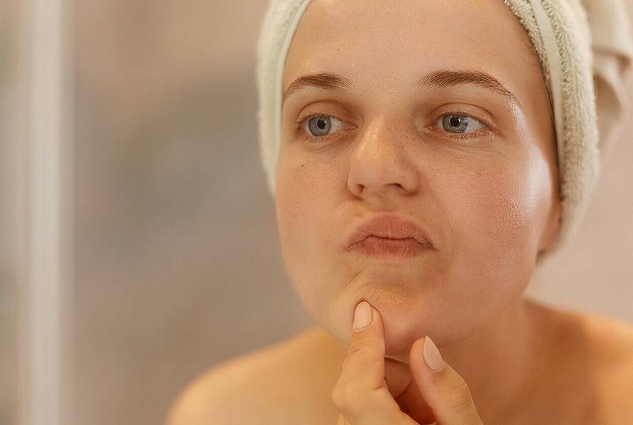 how to improve oily, dry, sensitive, acne prone skin 1