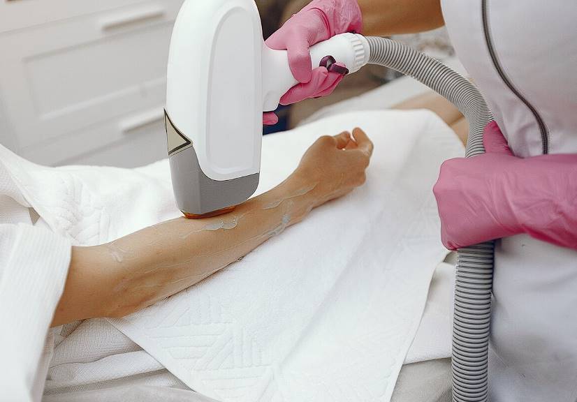 the myths about laser hair removal 2