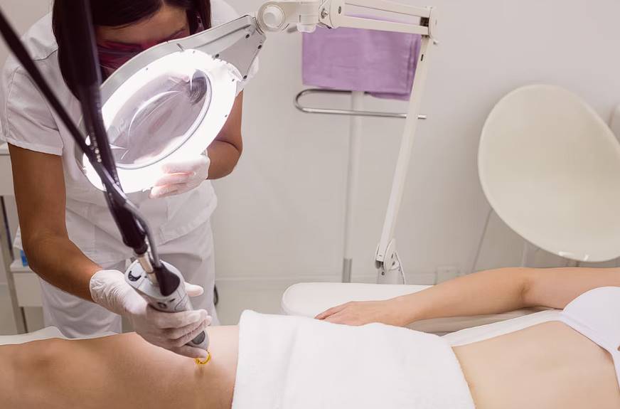 the myths about laser hair removal