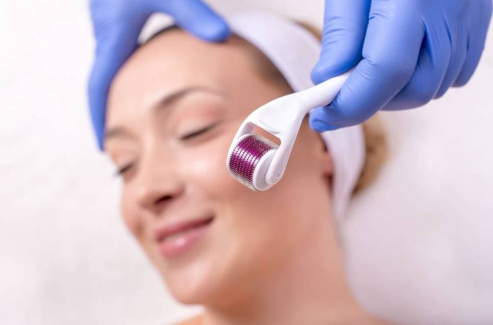 what is microneedling, and its potential dangers and benefits